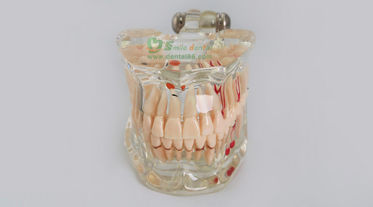 TM-C2 StandardTransparent